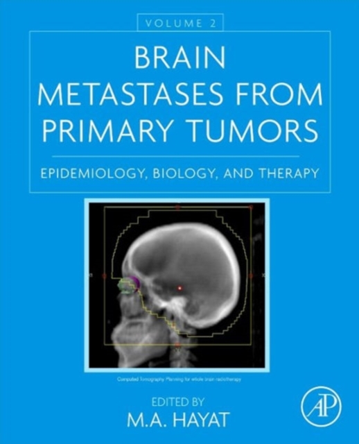 Brain Metastases from Primary Tumors, Volume 2 : Epidemiology, Biology, and Therapy, Hardback Book