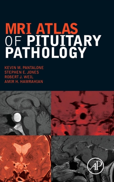 MRI Atlas of Pituitary Pathology, Hardback Book