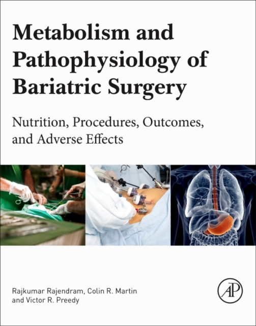 Metabolism and Pathophysiology of Bariatric Surgery : Nutrition, Procedures, Outcomes and Adverse Effects, Paperback / softback Book