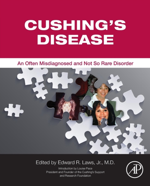 Cushing's Disease : An Often Misdiagnosed and Not So Rare Disorder, Paperback / softback Book