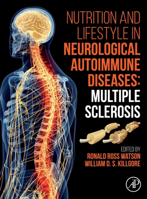 Nutrition and Lifestyle in Neurological Autoimmune Diseases : Multiple Sclerosis, Hardback Book