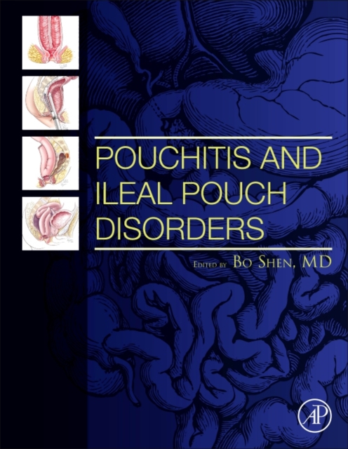Pouchitis and Ileal Pouch Disorders : A Multidisciplinary Approach for Diagnosis and Management, Hardback Book