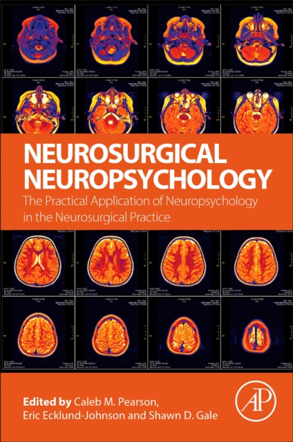 Neurosurgical Neuropsychology : The Practical Application of Neuropsychology in the Neurosurgical Practice, Paperback / softback Book