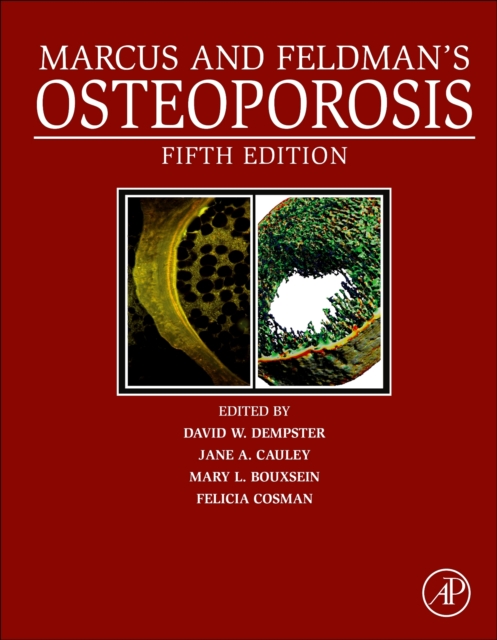 Marcus and Feldman's Osteoporosis, Multiple-component retail product Book