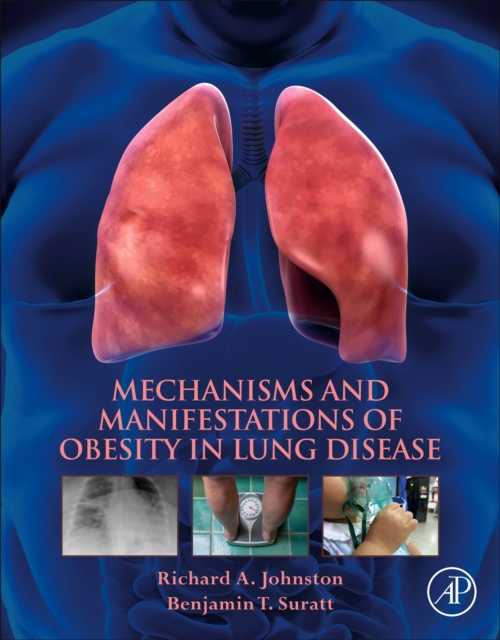 Mechanisms and Manifestations of Obesity in Lung Disease, Paperback / softback Book