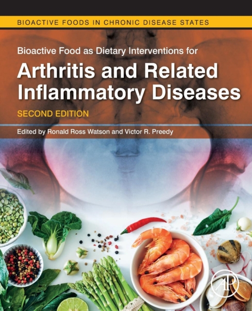 Bioactive Food as Dietary Interventions for Arthritis and Related Inflammatory Diseases, Paperback / softback Book