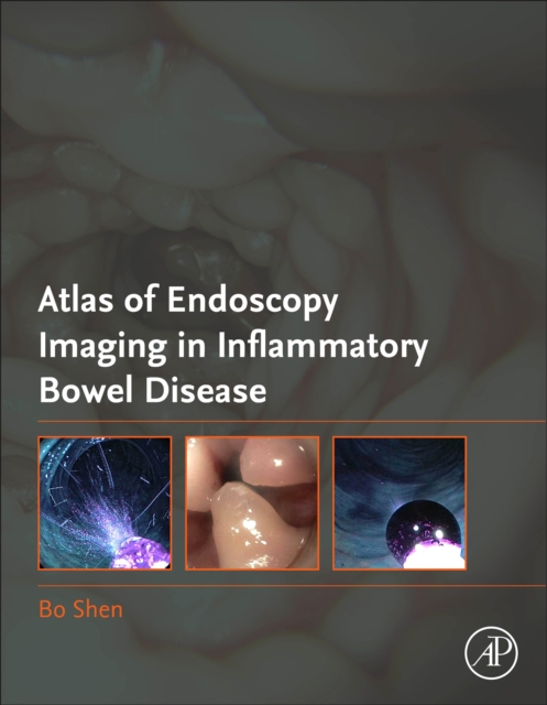 Atlas of Endoscopy Imaging in Inflammatory Bowel Disease, Hardback Book