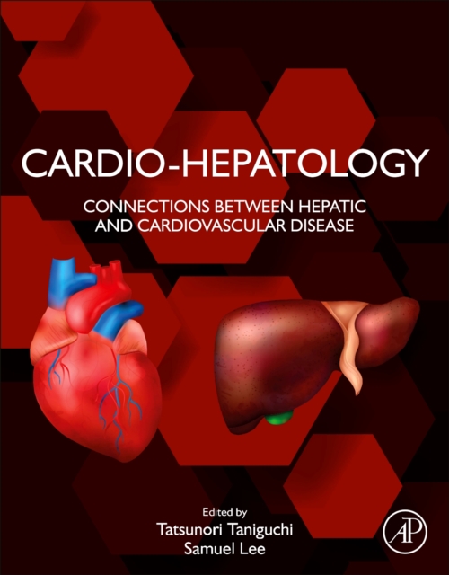 Cardio-Hepatology : Connections Between Hepatic and Cardiovascular Disease, Paperback / softback Book