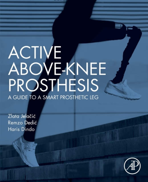 Active Above-Knee Prosthesis : A Guide to a Smart Prosthetic Leg, Paperback / softback Book