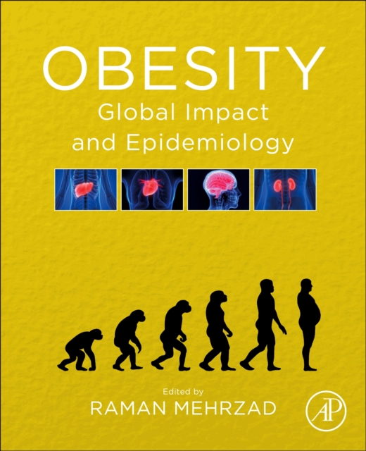 Obesity : Global Impact and Epidemiology, Paperback / softback Book