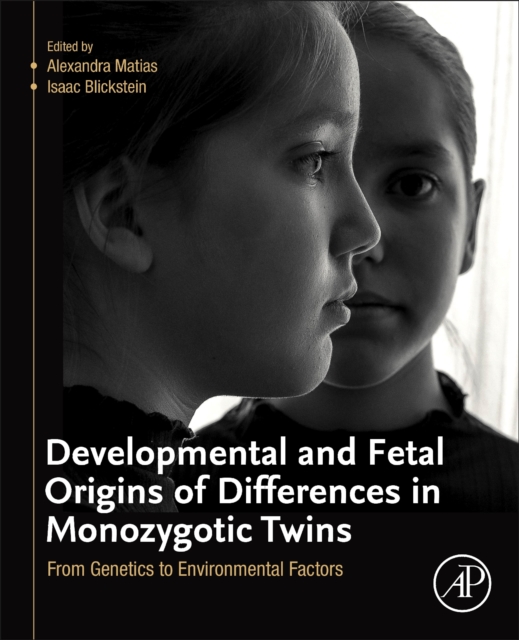 Developmental and Fetal Origins of Differences in Monozygotic Twins : From Genetics to Environmental Factors, Paperback / softback Book