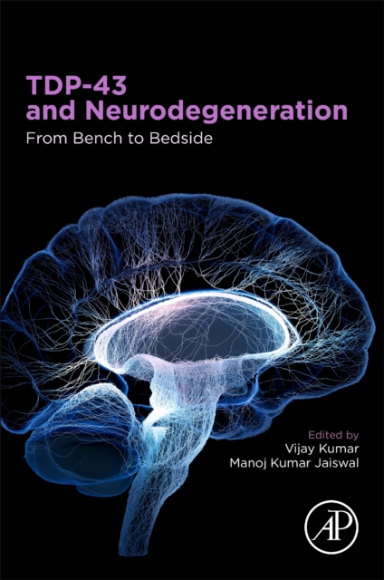 TDP-43 and Neurodegeneration : From Bench to Bedside, Paperback / softback Book