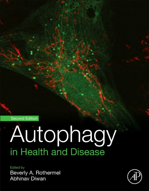 Autophagy in Health and Disease, Paperback / softback Book