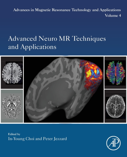 Advanced Neuro MR Techniques and Applications : Volume 4, Paperback / softback Book