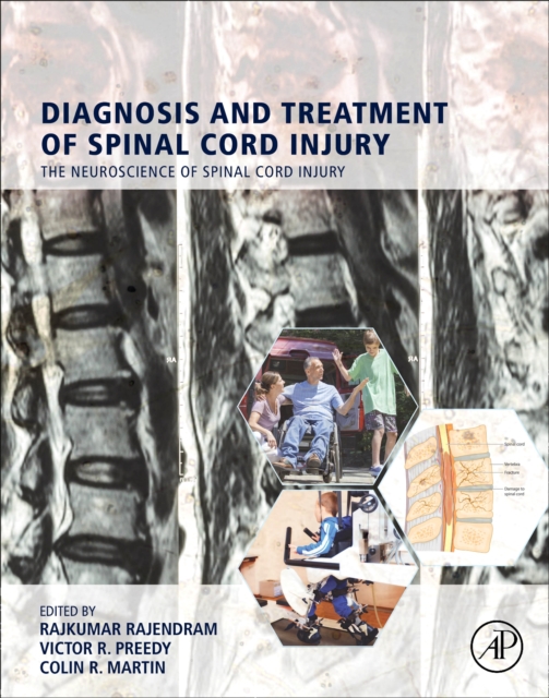 Diagnosis and Treatment of Spinal Cord Injury, Hardback Book