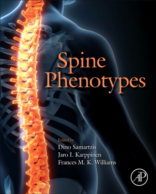 Spine Phenotypes, Hardback Book