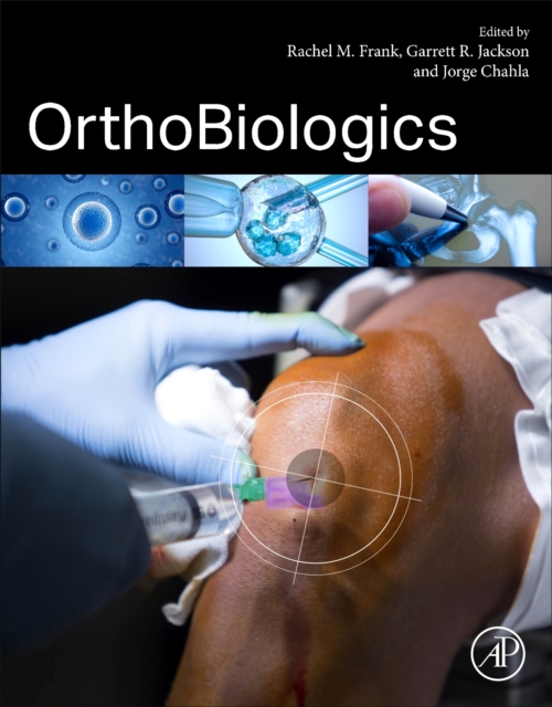 OrthoBiologics, Paperback / softback Book
