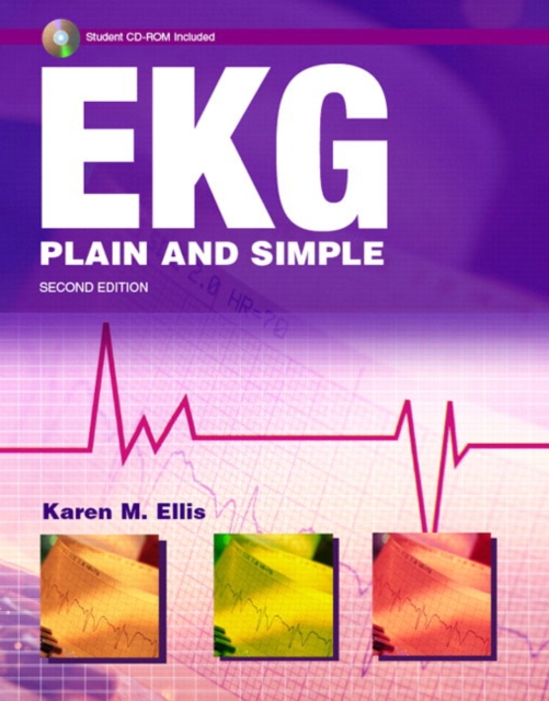 Ekg Plain and Simple, Mixed media product Book