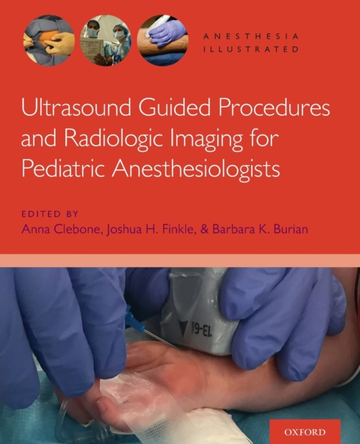 Ultrasound Guided Procedures and Radiologic Imaging for Pediatric Anesthesiologists, Paperback / softback Book