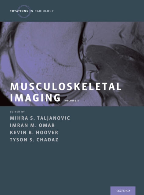 Musculoskeletal Imaging Volume 2 : Metabolic, Infectious, and Congenital Diseases; Internal Derangement of the Joints; and Arthrography and Ultrasound, PDF eBook
