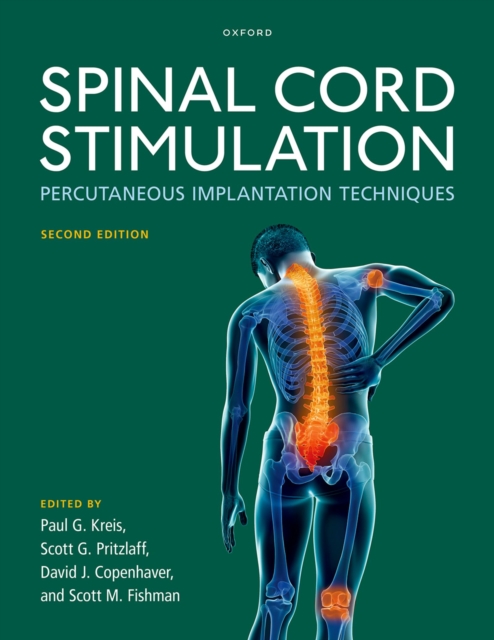 Spinal Cord Stimulation : Percutaneous Implantation Techniques, PDF eBook