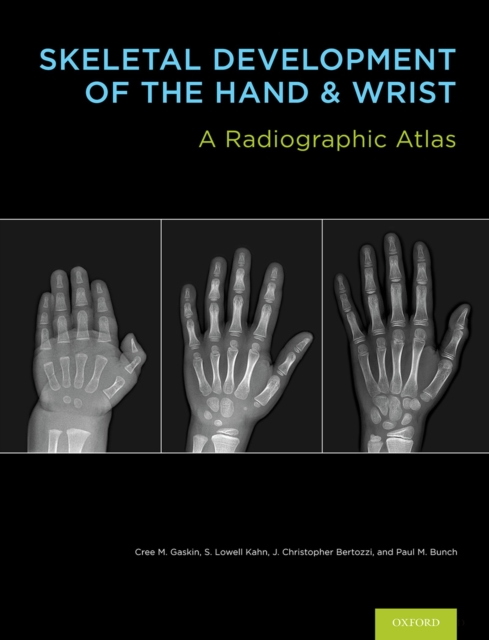 Skeletal Development of the Hand and Wrist : A Radiographic Atlas and Digital Bone Age Companion, EPUB eBook