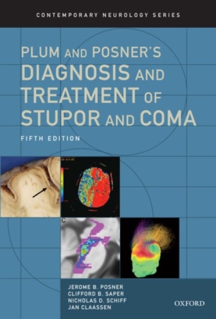 Plum and Posner's Diagnosis and Treatment of Stupor and Coma, Hardback Book