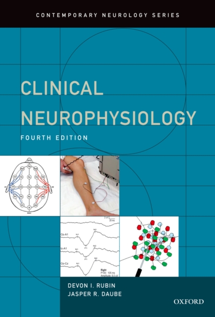 Clinical Neurophysiology, PDF eBook