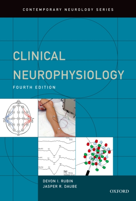 Clinical Neurophysiology, EPUB eBook