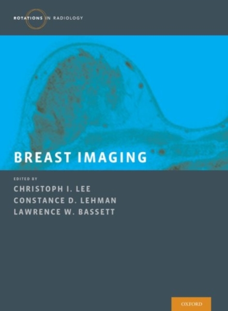 Breast Imaging, Hardback Book