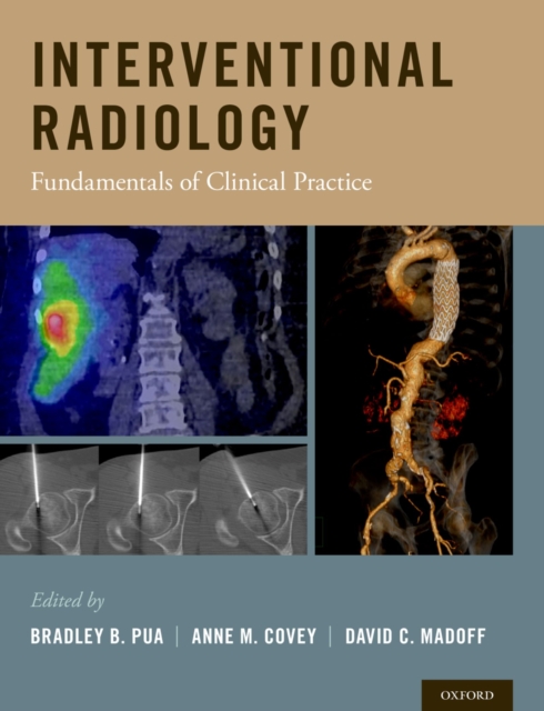 Interventional Radiology : Fundamentals of Clinical Practice, PDF eBook