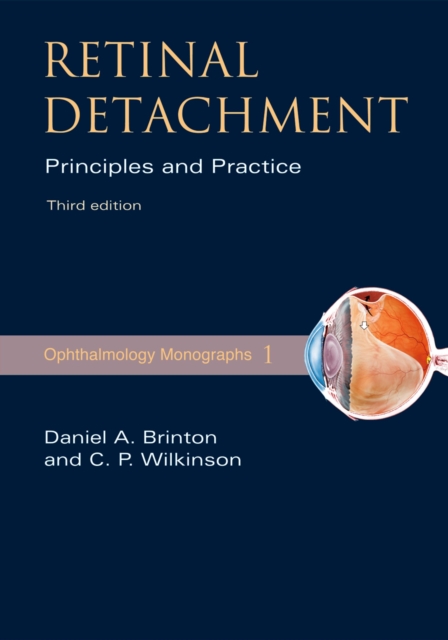 Retinal Detachment : Priniciples and Practice, EPUB eBook