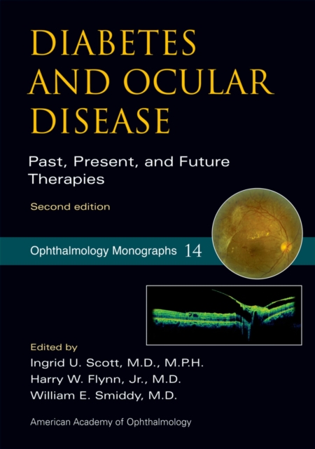 Diabetes and Ocular Disease : Past, Present, and Future Therapies, EPUB eBook