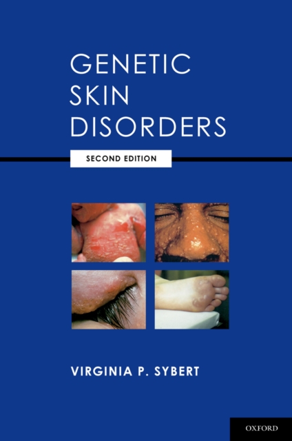 Genetic Skin Disorders, EPUB eBook