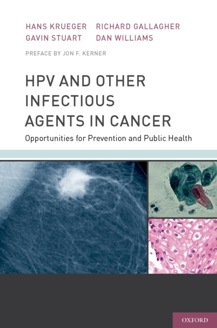 HPV and Other Infectious Agents in Cancer : Opportunities for Prevention and Public Health, EPUB eBook