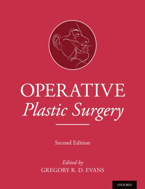 Operative Plastic Surgery, PDF eBook