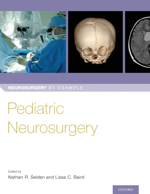 Pediatric Neurosurgery, Paperback / softback Book