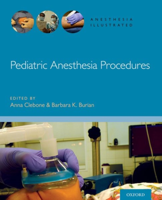 Pediatric Anesthesia Procedures, Paperback / softback Book