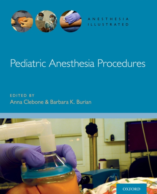 Pediatric Anesthesia Procedures, PDF eBook