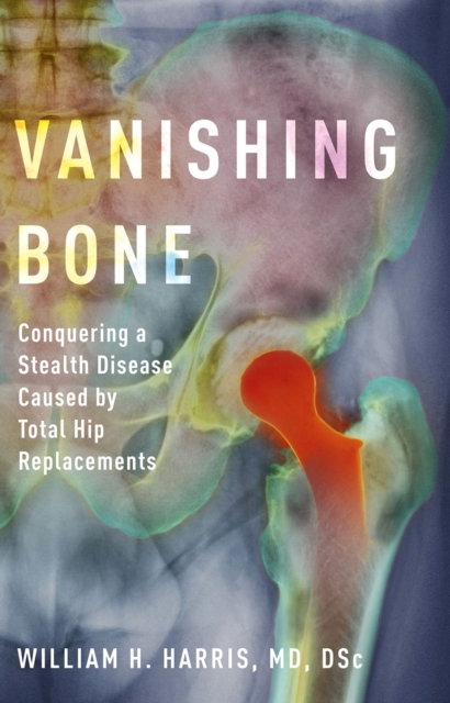 Vanishing Bone : Conquering a Stealth Disease Caused by Total Hip Replacements, PDF eBook
