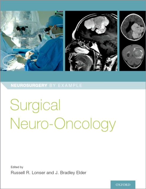 Surgical Neuro-Oncology, EPUB eBook