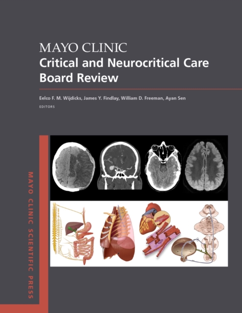 Mayo Clinic Critical and Neurocritical Care Board Review, PDF eBook