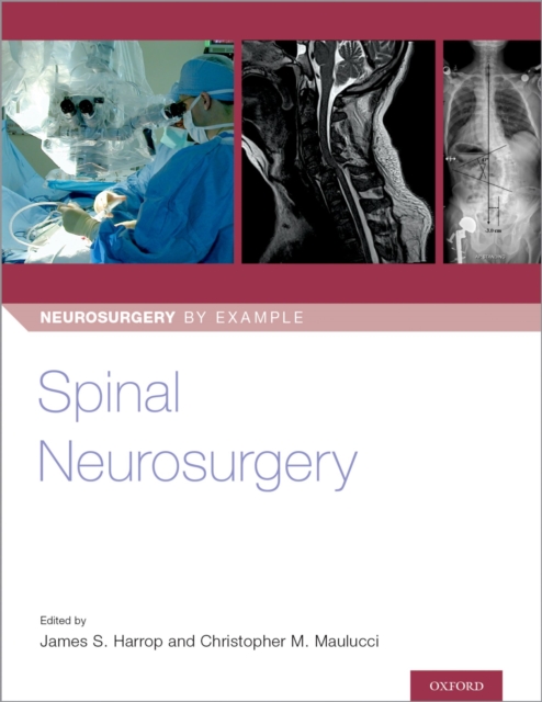 Spinal Neurosurgery, PDF eBook