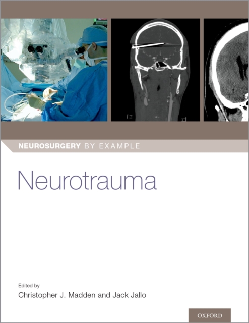 Neurotrauma, EPUB eBook