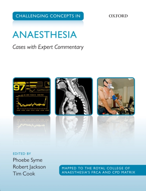 Challenging Concepts in Anaesthesia : Cases with Expert Commentary, PDF eBook