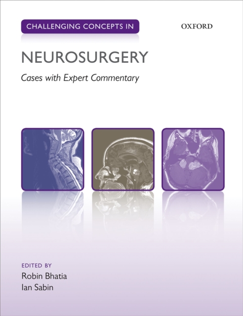 Challenging Concepts in Neurosurgery : Cases with Expert Commentary, EPUB eBook