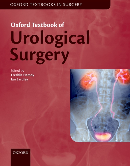 Oxford Textbook of Urological Surgery, PDF eBook