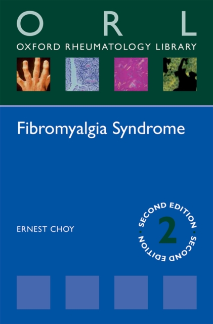Fibromyalgia Syndrome, PDF eBook