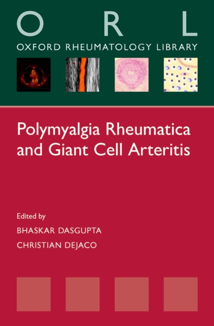Polymyalgia Rheumatica and Giant Cell Arteritis, PDF eBook