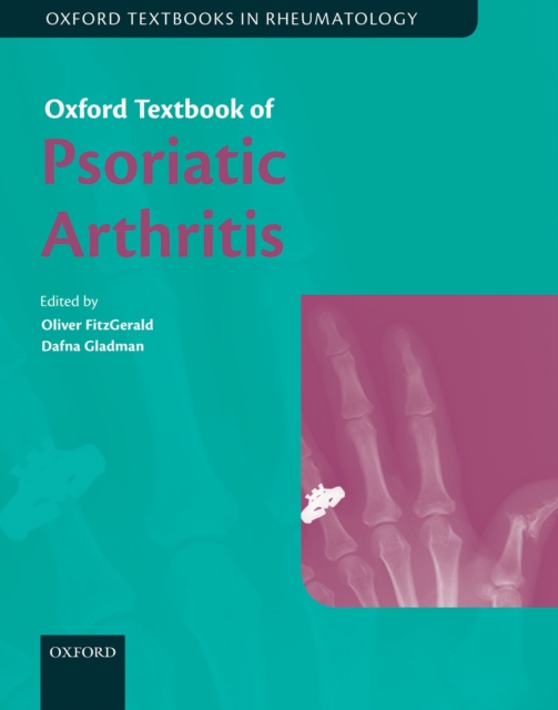 Oxford Textbook of Psoriatic Arthritis, PDF eBook